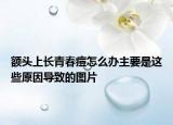 额头上长青春痘怎么办主要是这些原因导致的图片
