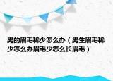 男的眉毛稀少怎么办（男生眉毛稀少怎么办眉毛少怎么长眉毛）