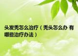 头发秃怎么治疗（秃头怎么办 有哪些治疗办法）