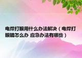 电焊打眼用什么办法解决（电焊打眼睛怎么办 应急办法有哪些）
