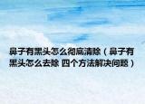 鼻子有黑头怎么彻底清除（鼻子有黑头怎么去除 四个方法解决问题）