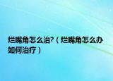 烂嘴角怎么治?（烂嘴角怎么办 如何治疗）