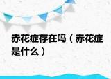赤花症存在吗（赤花症是什么）