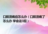 口腔溃疡应怎么办（口腔溃疡了怎么办 学会这3招）