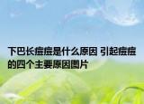下巴长痘痘是什么原因 引起痘痘的四个主要原因图片