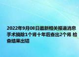 2022年9月08日最新相关报道消息 手术摘除1个肾十年后查出2个肾 检查结果出错