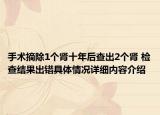 手术摘除1个肾十年后查出2个肾 检查结果出错具体情况详细内容介绍