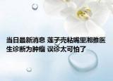 当日最新消息 莲子壳粘嘴里湘雅医生诊断为肿瘤 误诊太可怕了
