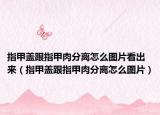 指甲盖跟指甲肉分离怎么图片看出来（指甲盖跟指甲肉分离怎么图片）