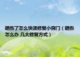 晒伤了怎么快速修复小窍门（晒伤怎么办 几大修复方式）