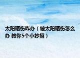 太阳晒伤咋办（被太阳晒伤怎么办 教你5个小妙招）