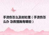 手烫伤怎么及时处理（手烫伤怎么办 急救措施有哪些）