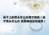 鼻子上的黑头怎么处理才彻底（鼻子黑头怎么办 需要确定这些信息）