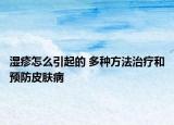 湿疹怎么引起的 多种方法治疗和预防皮肤病