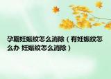 孕期妊娠纹怎么消除（有妊娠纹怎么办 妊娠纹怎么消除）