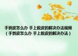 手剥皮怎么办 手上脱皮的解决办法视频（手剥皮怎么办 手上脱皮的解决办法）