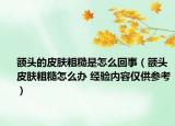 额头的皮肤粗糙是怎么回事（额头皮肤粗糙怎么办 经验内容仅供参考）
