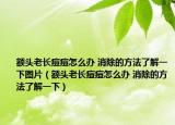 额头老长痘痘怎么办 消除的方法了解一下图片（额头老长痘痘怎么办 消除的方法了解一下）