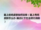 腿上的鸡皮肤如何去除（腿上有鸡皮肤怎么办 通过以下方法进行消除）