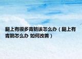 腿上有很多青筋该怎么办（腿上有青筋怎么办 如何改善）