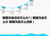 眼睛充血应该怎么办?（眼睛充血怎么办 眼睛充血怎么消除）