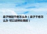 鼻子特别干疼怎么办（鼻子干疼怎么办 可以这样处理的）