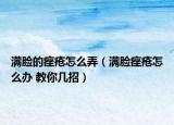 满脸的痤疮怎么弄（满脸痤疮怎么办 教你几招）