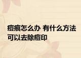 痘痕怎么办 有什么方法可以去除痘印