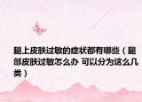 腿上皮肤过敏的症状都有哪些（腿部皮肤过敏怎么办 可以分为这么几类）