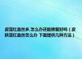 皮薄红血丝多,怎么办还能修复好吗（皮肤薄红血丝怎么办 下面提供几种方法）
