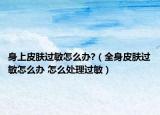 身上皮肤过敏怎么办?（全身皮肤过敏怎么办 怎么处理过敏）