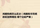 鸡眼和疣怎么区分（鸡眼和寻常疣的区别有哪些 哪个比较严重）