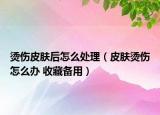 烫伤皮肤后怎么处理（皮肤烫伤怎么办 收藏备用）
