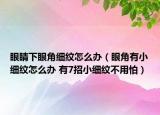 眼睛下眼角细纹怎么办（眼角有小细纹怎么办 有7招小细纹不用怕）