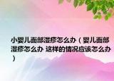 小婴儿面部湿疹怎么办（婴儿面部湿疹怎么办 这样的情况应该怎么办）