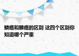 鳞癌和腺癌的区别 这四个区别你知道哪个严重