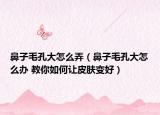 鼻子毛孔大怎么弄（鼻子毛孔大怎么办 教你如何让皮肤变好）