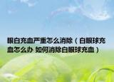 眼白充血严重怎么消除（白眼球充血怎么办 如何消除白眼球充血）