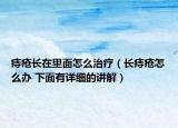 痔疮长在里面怎么治疗（长痔疮怎么办 下面有详细的讲解）