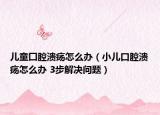 儿童囗腔溃疡怎么办（小儿口腔溃疡怎么办 3步解决问题）