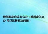 脸部脱皮应该怎么办（脸脱皮怎么办 可以这样解决问题）