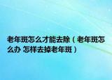 老年斑怎么才能去除（老年斑怎么办 怎样去掉老年斑）