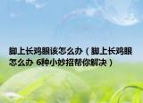 脚上长鸡眼该怎么办（脚上长鸡眼怎么办 6种小妙招帮你解决）