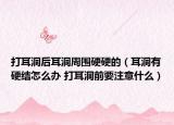 打耳洞后耳洞周围硬硬的（耳洞有硬结怎么办 打耳洞前要注意什么）