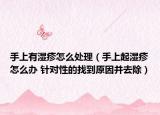 手上有湿疹怎么处理（手上起湿疹怎么办 针对性的找到原因并去除）