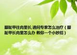 脚趾甲往肉里长,请问专家怎么治疗（脚趾甲长肉里怎么办 教你一个小妙招）