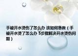 手被开水烫伤了怎么办 该如何急救（手被开水烫了怎么办 5步骤解决开水烫伤问题）