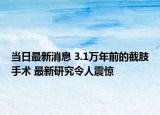 当日最新消息 3.1万年前的截肢手术 最新研究令人震惊