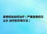 青春痘该如何治疗（严重青春痘怎么办 治疗的常用方法）