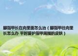 脚指甲长在肉里面怎么治（脚指甲往肉里长怎么办 平时爱护指甲周围的皮肤）